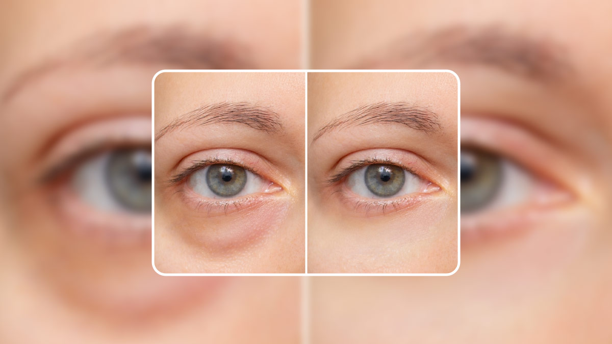 आंखों का रंग और सूजन बताती है सेहत का हाल, त्रिदोष संतुलन सबसे बड़ा कारण  