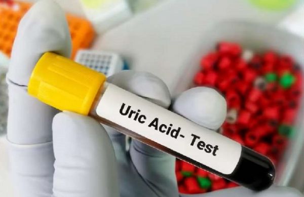 सेहत: हाई यूरिक एसिड को कम कर सकते हैं ये घरेलू उपाय
