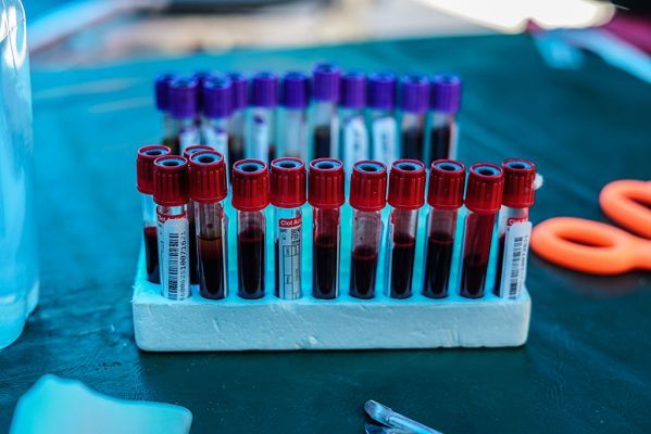 स्वास्थ्य मंत्रालय ने रक्त उत्पाद परीक्षण नियमों में बदलाव का मसौदा किया जारी