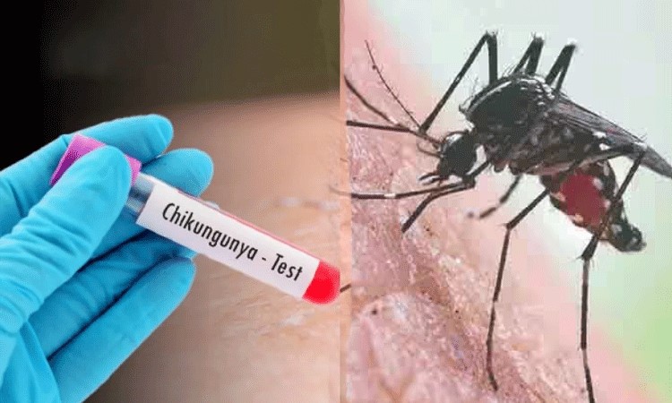 तमिलनाडु में कई जिलाें में बढ़ा चिकनगुनिया संक्रमण, जनस्वास्थ्य विभाग ने जारी एडवाइजरी