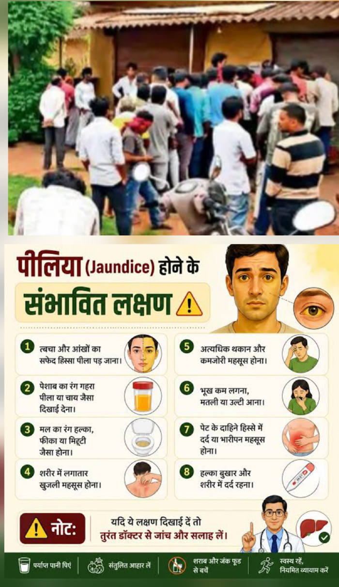 बस्तर में पीलिया का प्रकाेप, देसी इलाज के लिए मरीजों की लगी कतार