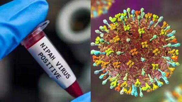 24 घंटे निगरानी में निपाह संक्रमित दो नर्सें, हालत अब भी गंभीर